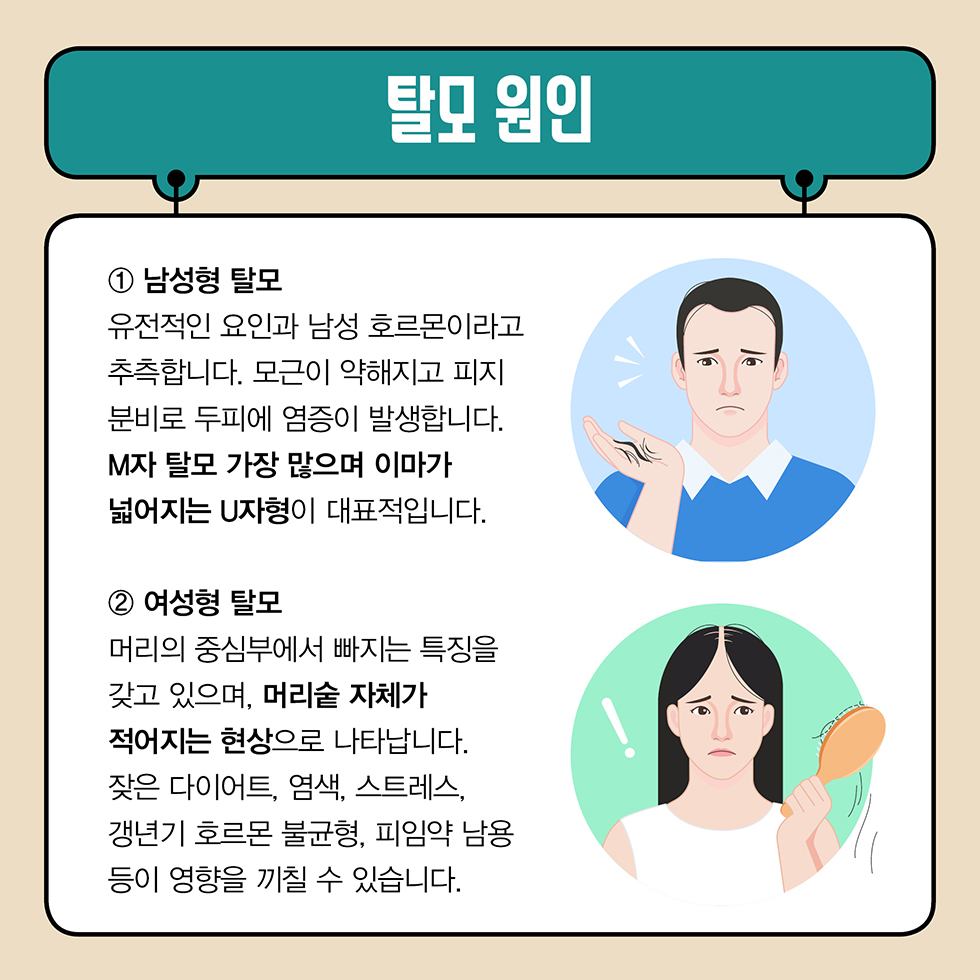 정수리 탈모
